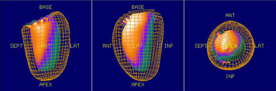 nuclearMedicineImaging01