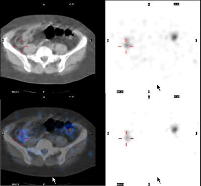 nuclearMedicineImaging02