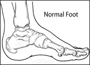 Normal Foot