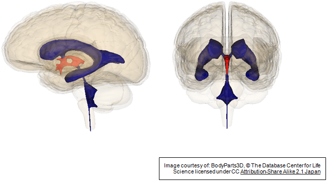 Figure 2 - The ventricles in the brain