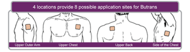 Transdermal patch sites