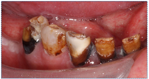 Tips And Advice To Help You To Look After Your Children's Teeth