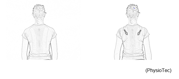 First image is of person standing or sitting with arms resting comfortably in front of their body. Second image shows the person pulling their shoulder blades together slightly.
