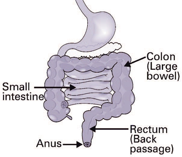 rectal cancer nhs