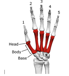 Diagram of skeleton of fingers of hand showing the metacarpal bones as described below.