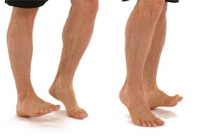 Patella dislocation Advice regarding healing and recovery Hull University Teaching Hospitals NHS Trust
