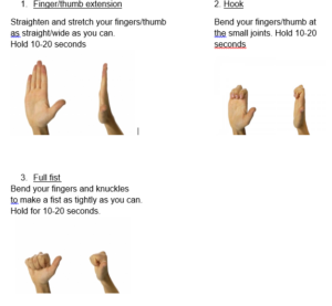 Mallet finger - NHS