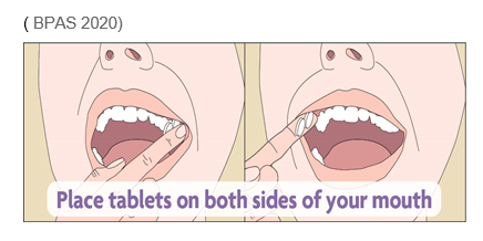 Image of how to place the tablets into the mouth between the upper cheek and gum