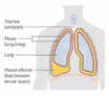 Pleural Effusion | Hull University Teaching Hospitals NHS Trust