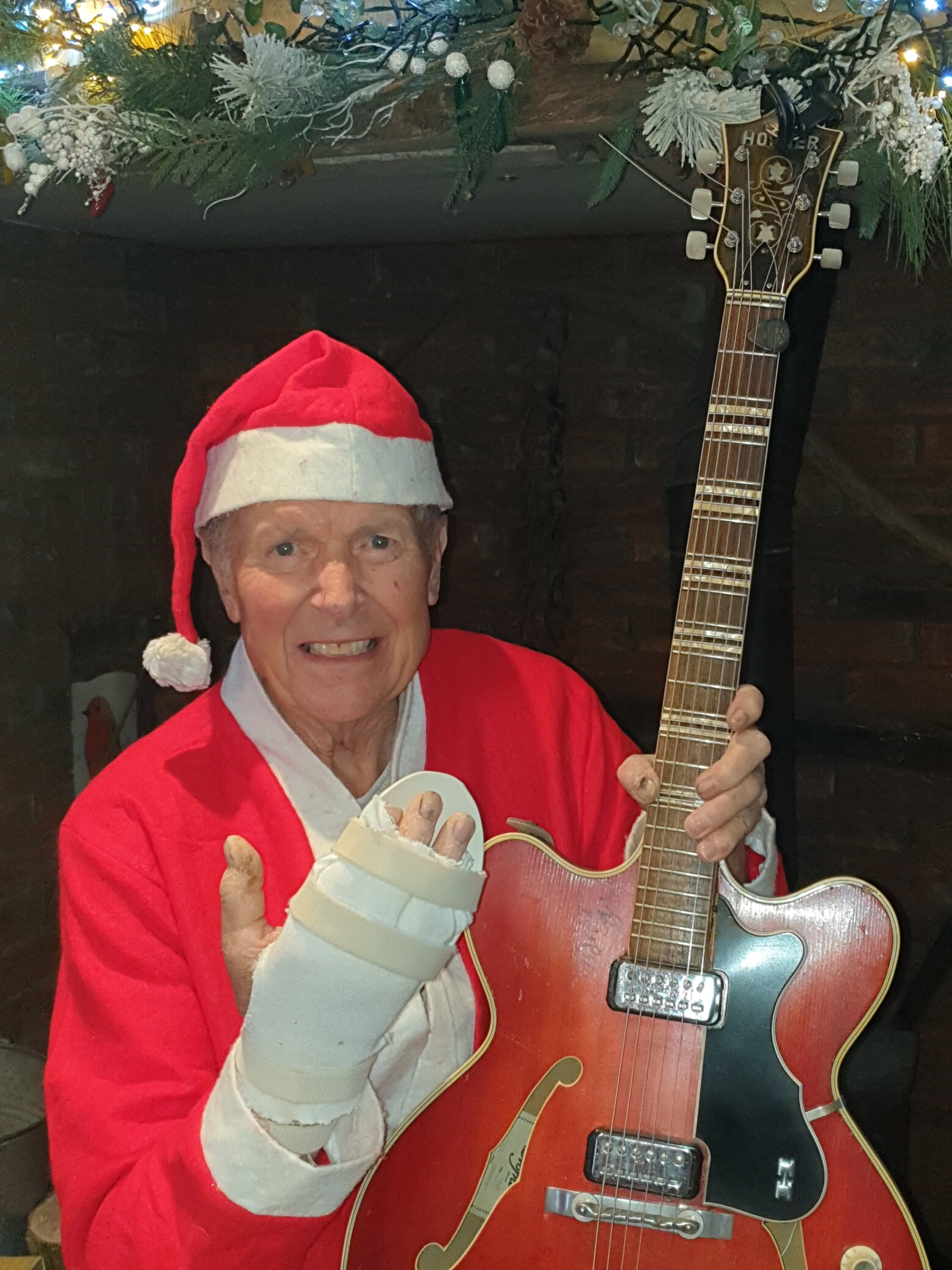 A man dressed as Santa holding a guitar. His right hand is in plaster