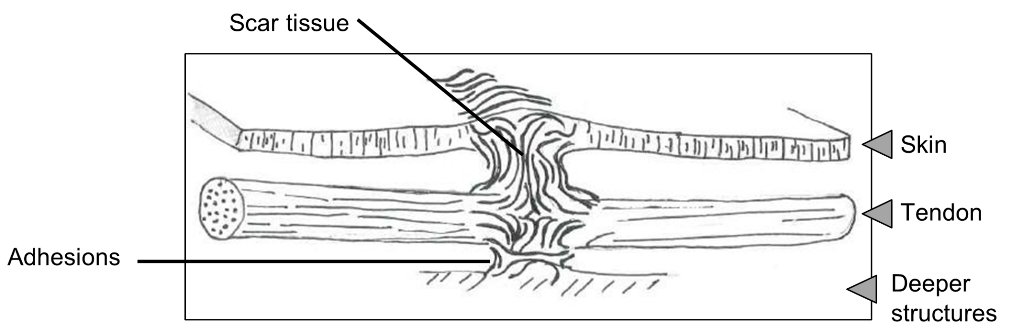 Scar Form Basic Scar Care: Information for Patient, Carers and Relatives | Hull ...