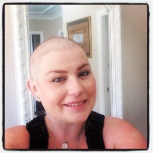 Head and shoulders image of Zowie Fussey, in which Zowie has lost most of her hair due to cancer treatment.